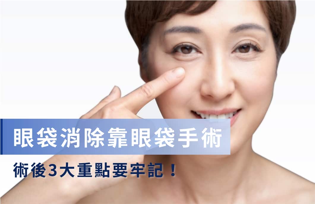 如何消除眼袋？眼袋類型、成因、醫美消除療程一次看！